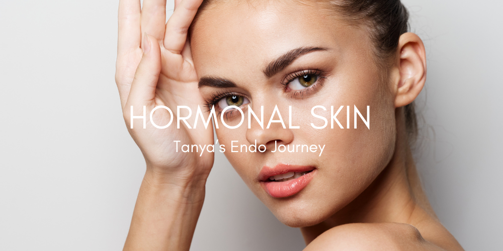 Front-facing image of a woman gently holding the side of her face, with overlaid text reading: 'Hormonal Skin: Tanya's Endo Journey'.