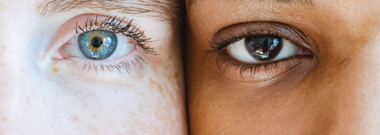 Can You Use Vitamin C Serum Under Your Eyes?