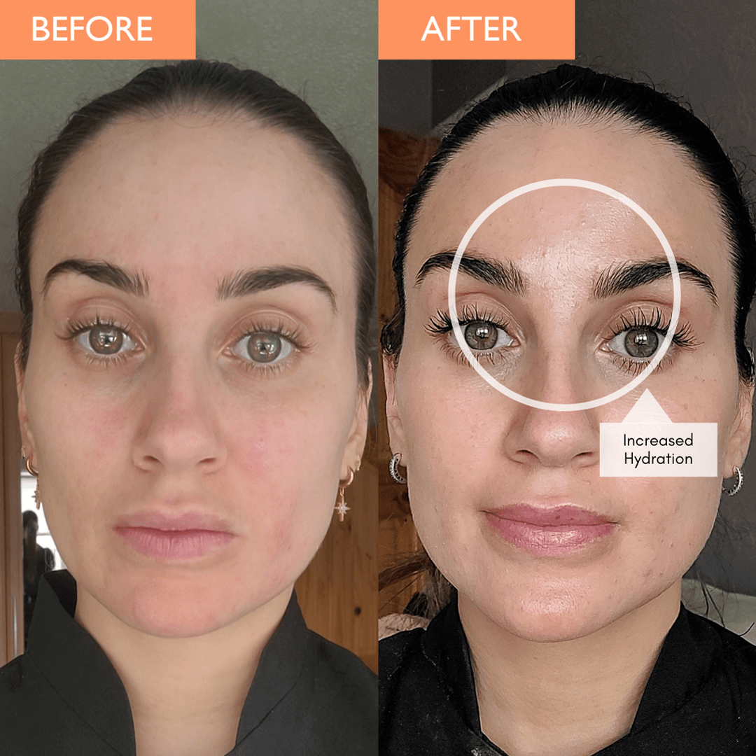 Vitamin C serum before and after image, showing a lady with increased hydration around the forehead after using the vitamin c face serum