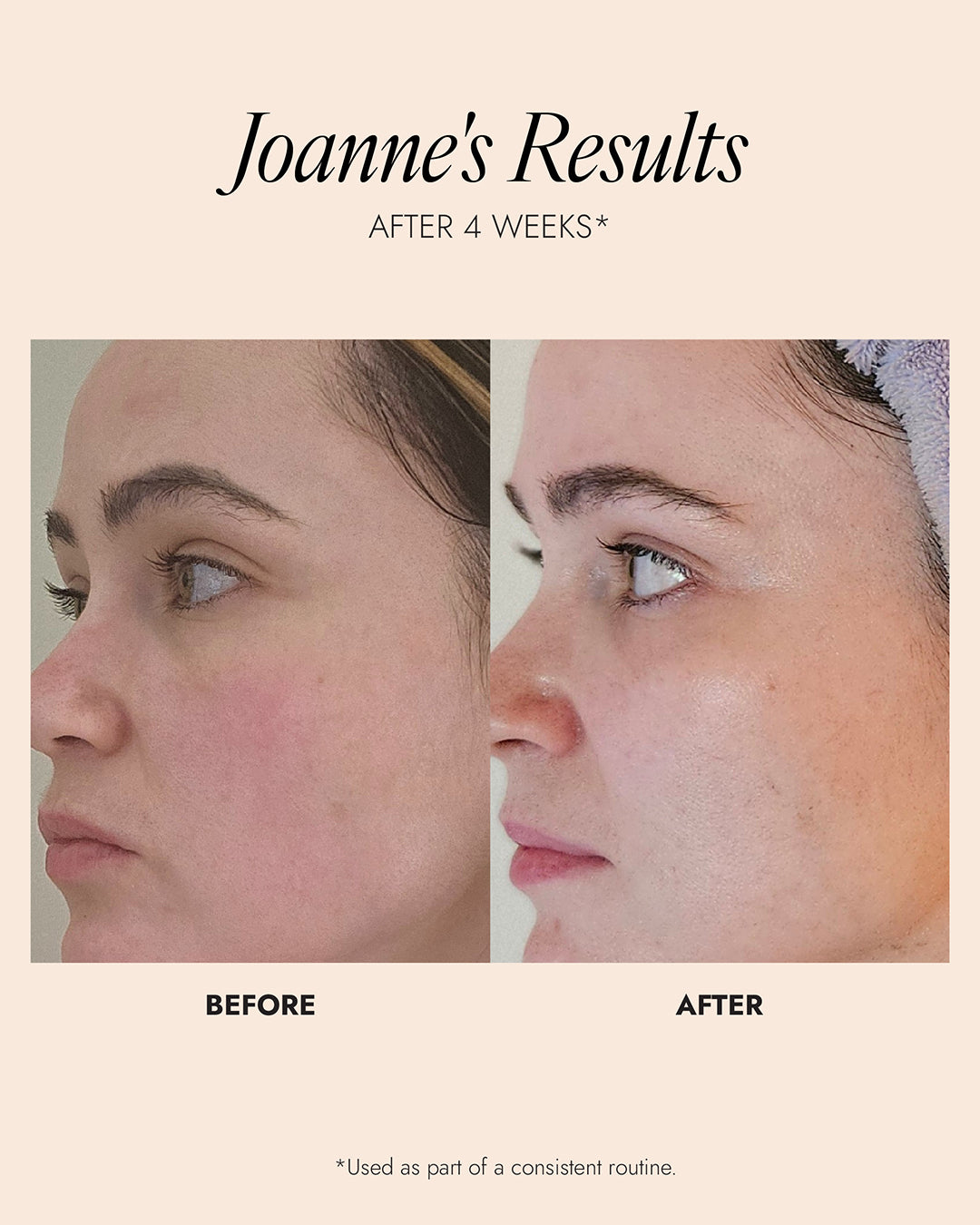Before and after comparison of a woman's face with text indicating results after 4 weeks. Results show a reduction in skin redness and an increase in skin hydration and glow