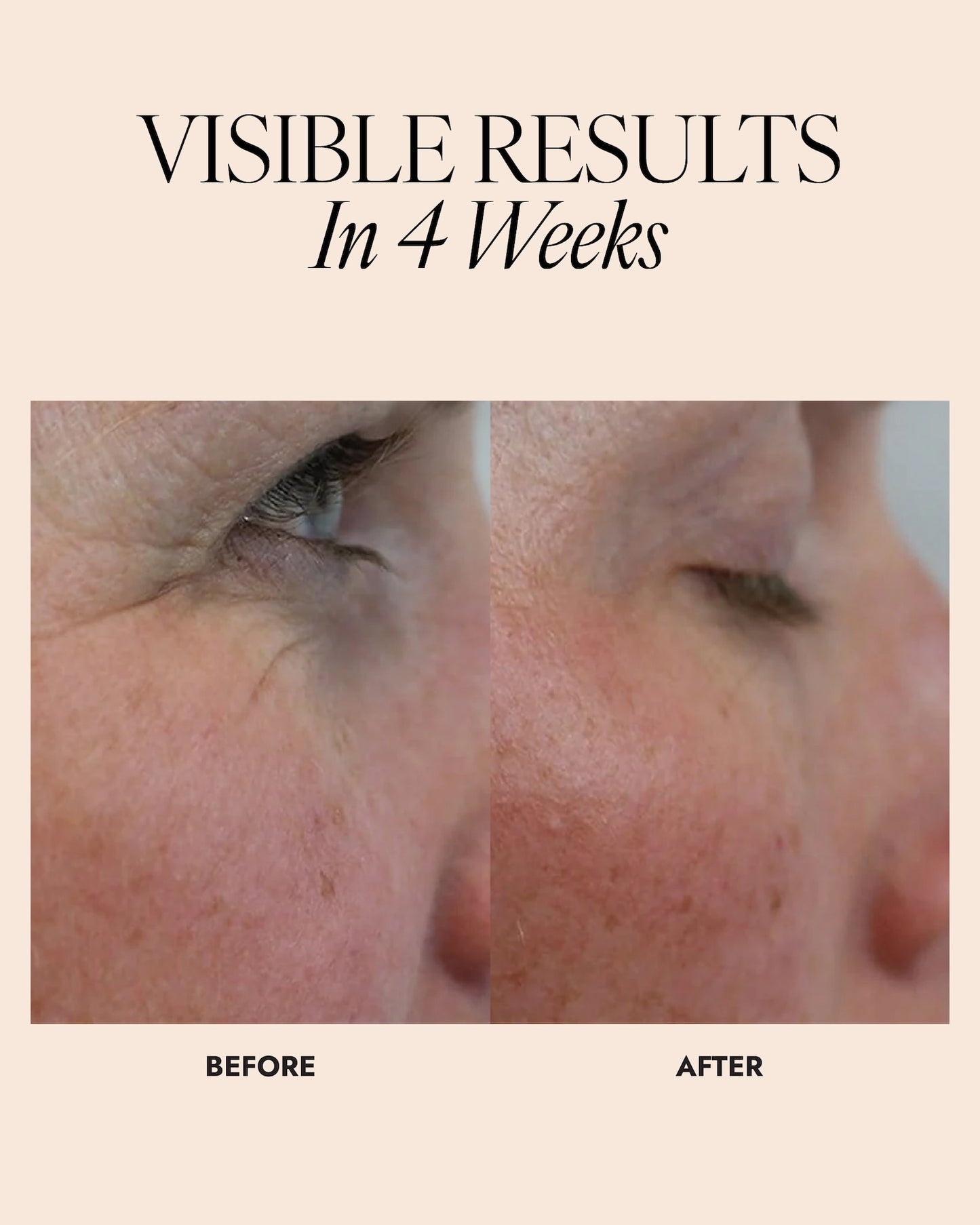 Before and after comparison of skin around the eyes showing a visible improvement in lines around the eyes with text 'Visible Results In 4 Weeks'