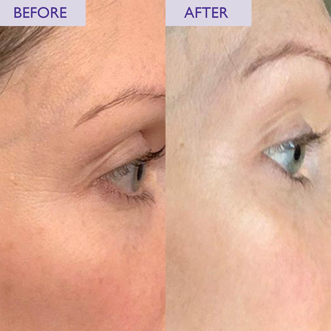 Overnight Retinol Powerbalm Level 2 50ml