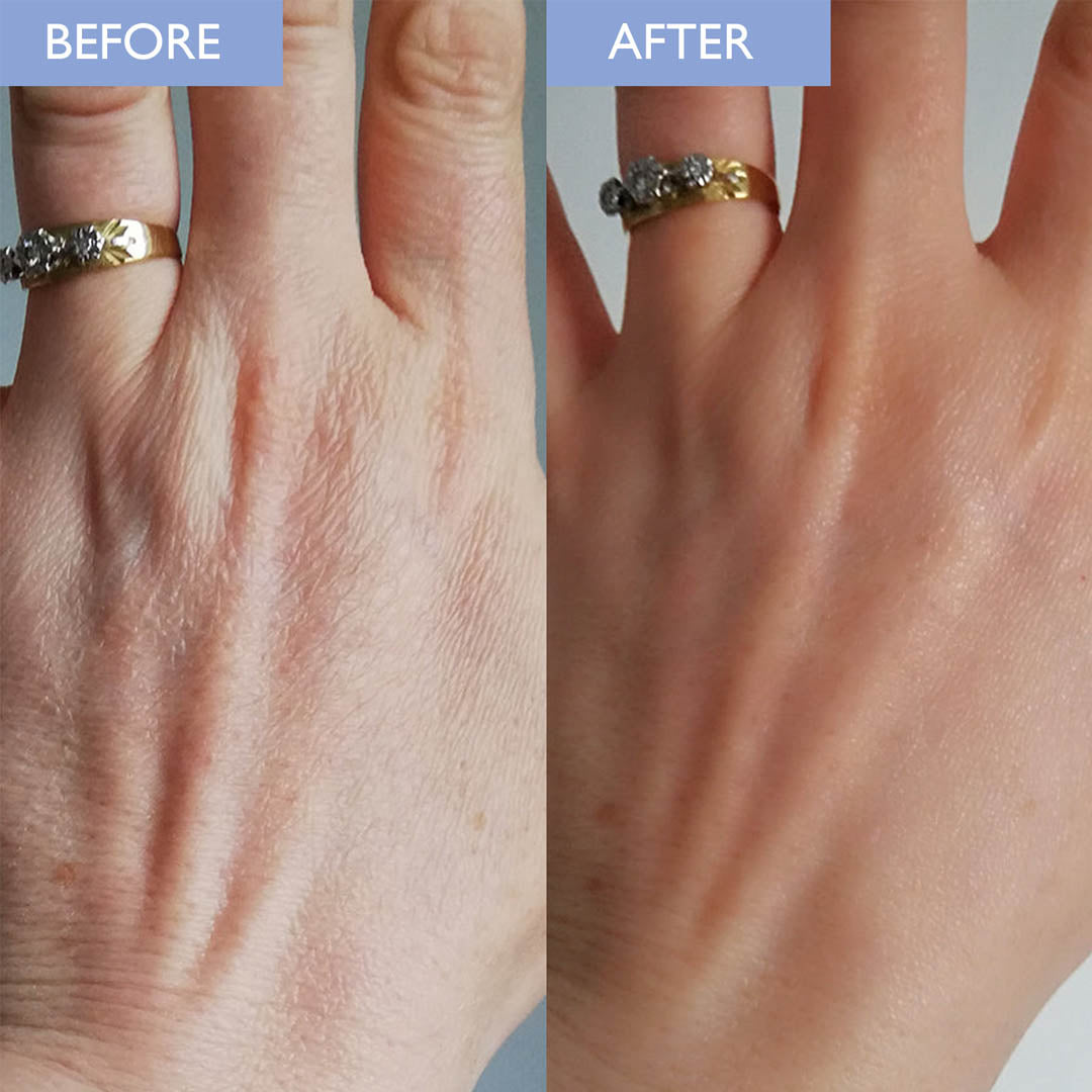 A before and after image showing improvement in dry hands after using daily body lotion with aloe vera and vitamin e