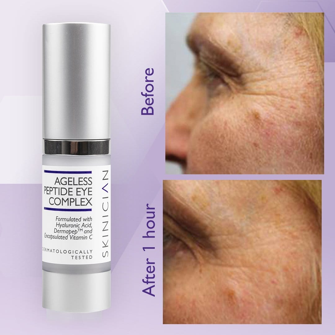 A before and after image of a lady showing reduced lines around the eye area within 1 hour