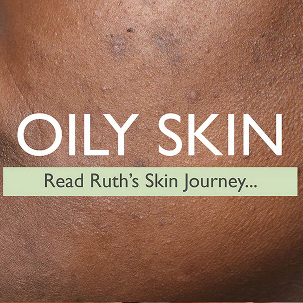 Close up image of skin featuring the text 'Oily skin - Read Ruth's Skin Journey'