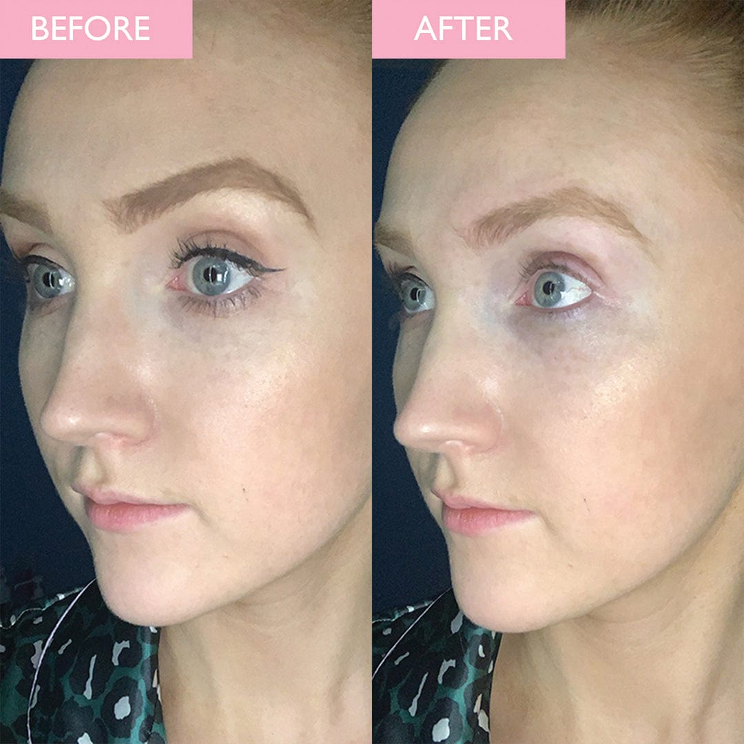 Before and After Image of a lady having used the eye soothing make up remover