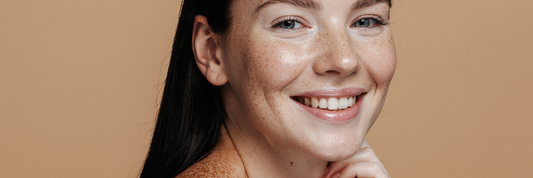 Image of women, facing front, smiling with a healthy complexion and skin freckles.