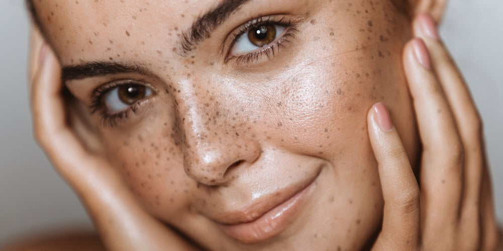 All you need to know about your skin barrier & how to look after it