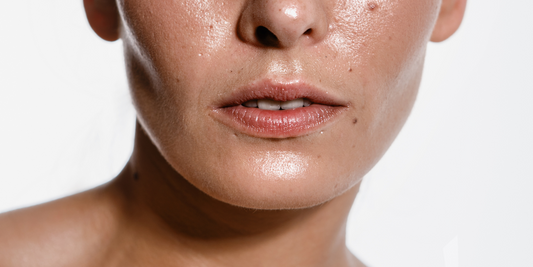 Transformative Skincare Ingredients for Oily Skin