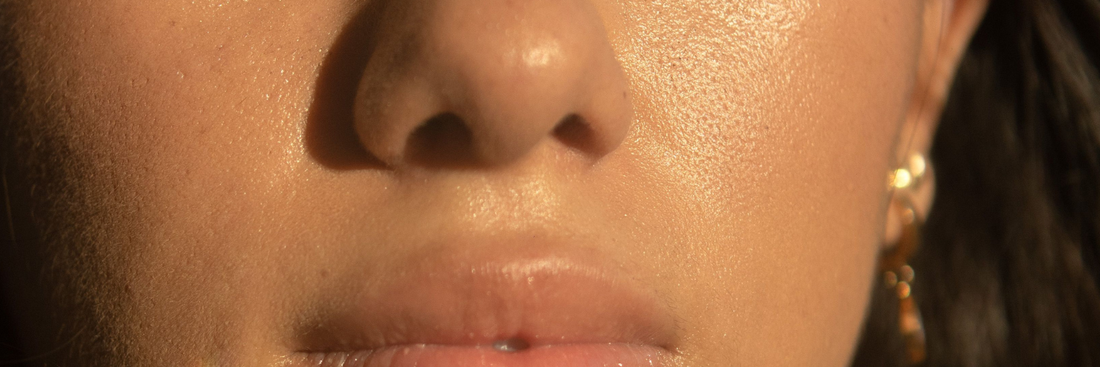 Close up of a woman's face showing oily skin and larger pores, indicating high sebum production