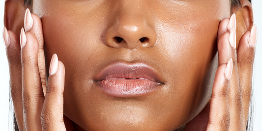 Image of a woman with oily skin