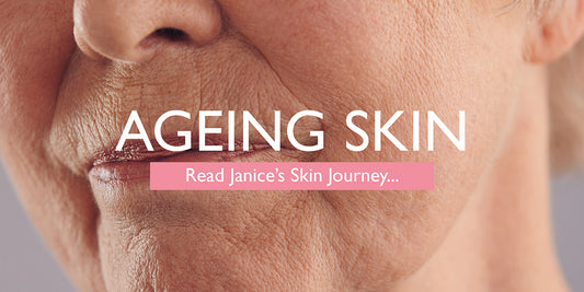 Janice’s Ageing Skin Journey to Happy, Healthy Skin