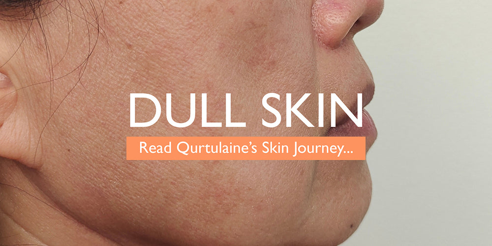 Dry Skin Blog – Skinician