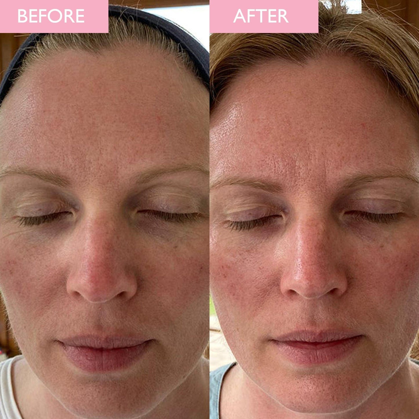 A before and after image of a lady who has used SKINICIAN SPF Moisturiser.  Brighter more nourished skin can be seen