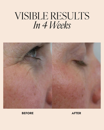 Before and after comparison of skin around the eyes showing a visible improvement in lines around the eyes with text 'Visible Results In 4 Weeks'