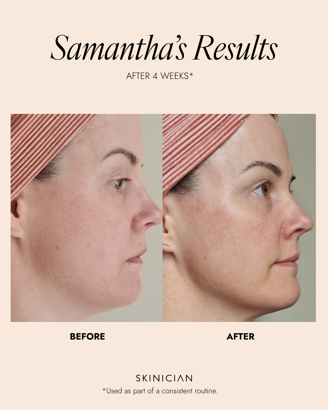 Before and after skin comparison of a woman with a pink headband, showing glowing results from a Daily Defence SPF moisturiser after 4 weeks.
