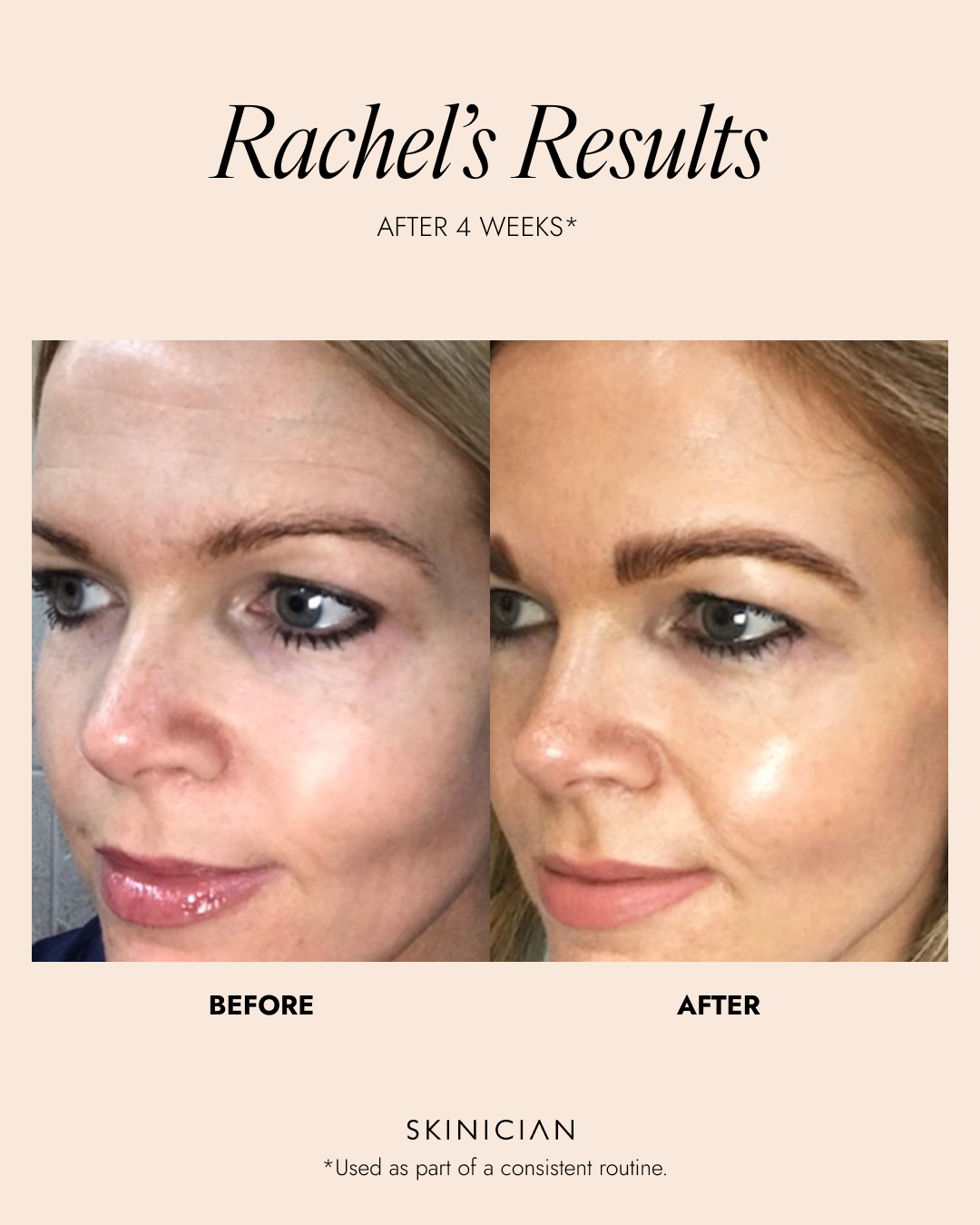 Before and after image of Rachel's results are using Time Delay Cream for 4 weeks. The results show reduced fine lines, wrinkles and a plump, healthy skin glow.