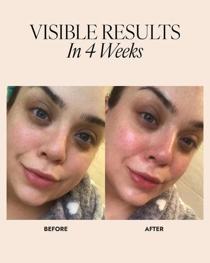 Image of customer's skin before and after showing an increase in skin luminosity after 4 weeks