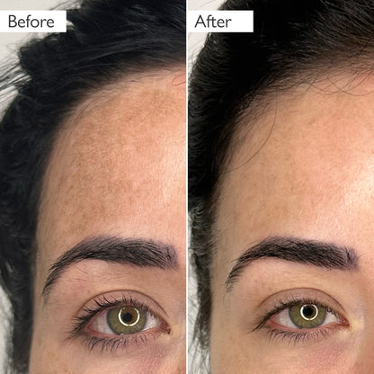 Glycolic Acid Exfoliating Toner 100ml
