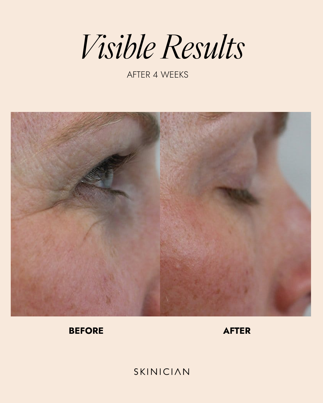 Peptide Eye Complex 15ml