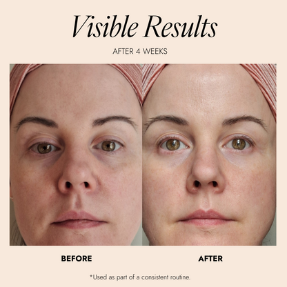 Before and after comparison of a woman's face with text indicating visible results after 4 weeks from a skinician.