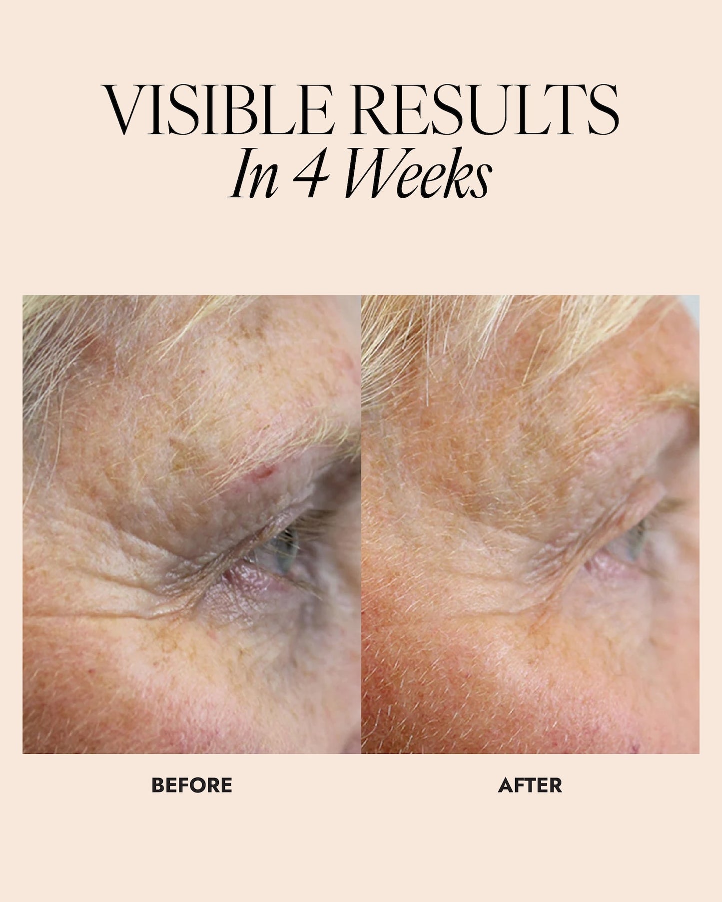 Before and after comparison of a person's eye area with text 'Visible Results In 4 Weeks'.