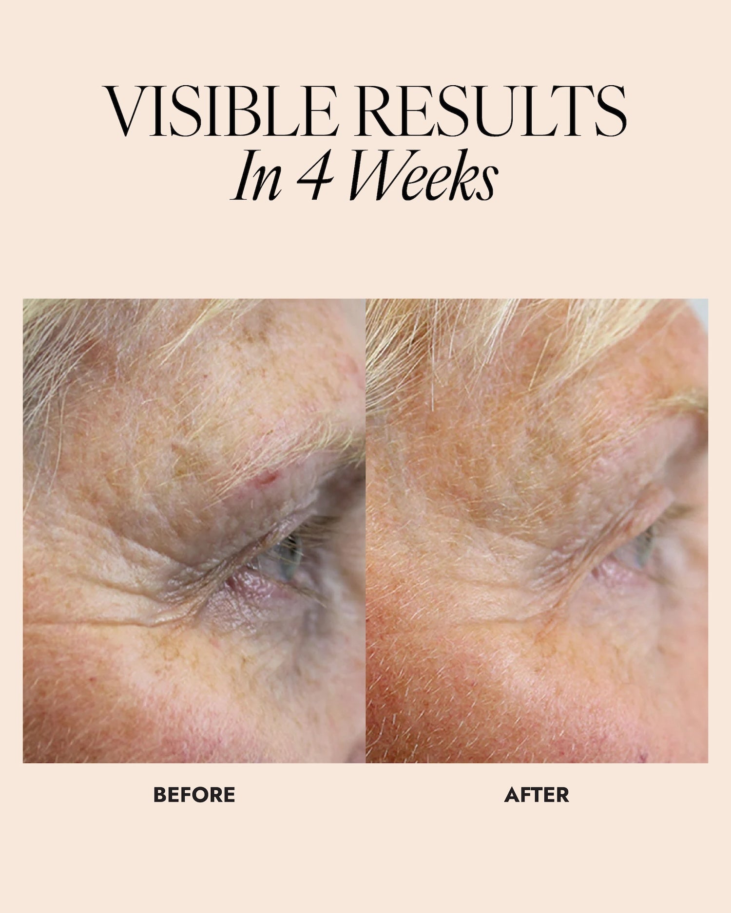 Before and after comparison of a person's eye area with text 'Visible Results In 4 Weeks'.