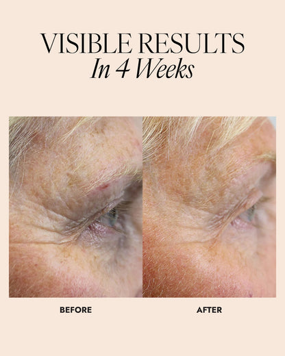 Before and after comparison of a person's eye area with text 'Visible Results In 4 Weeks'.
