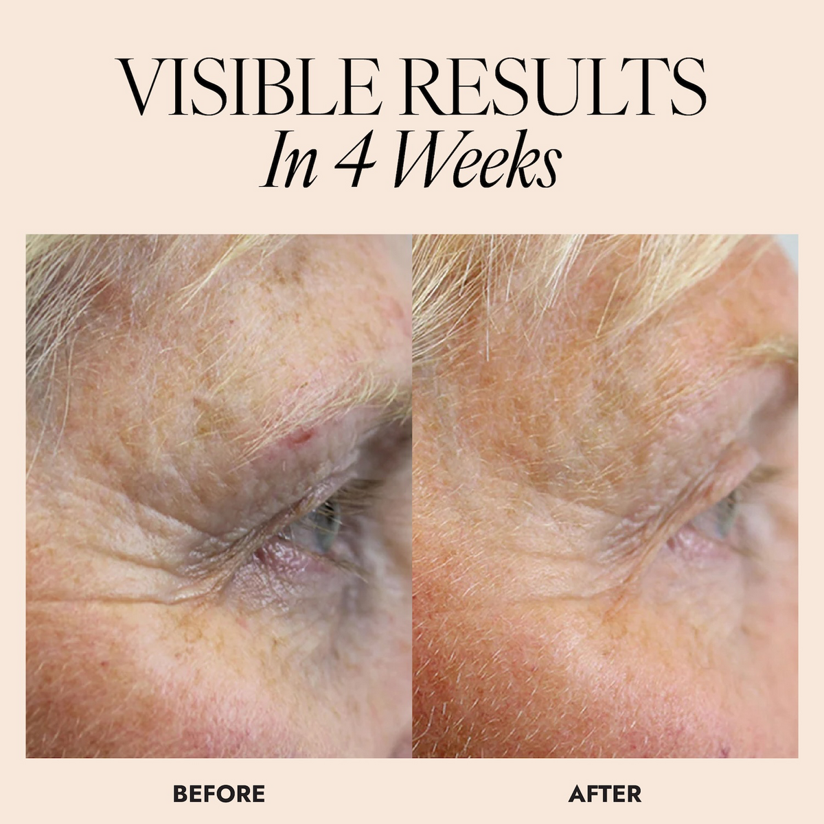 Before and after comparison of a person's eye area with text 'Visible Results In 4 Weeks'.