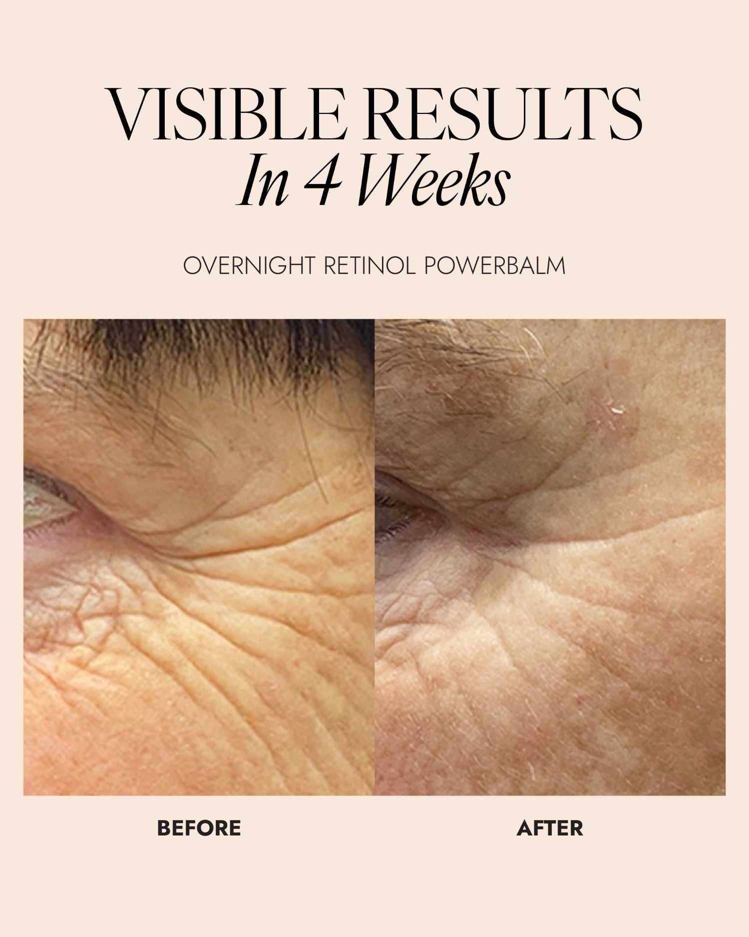 Before and after comparison of skin treatment with text 'Visible Results In 4 Weeks' and 'Overnight Retinol PowerBalm'.