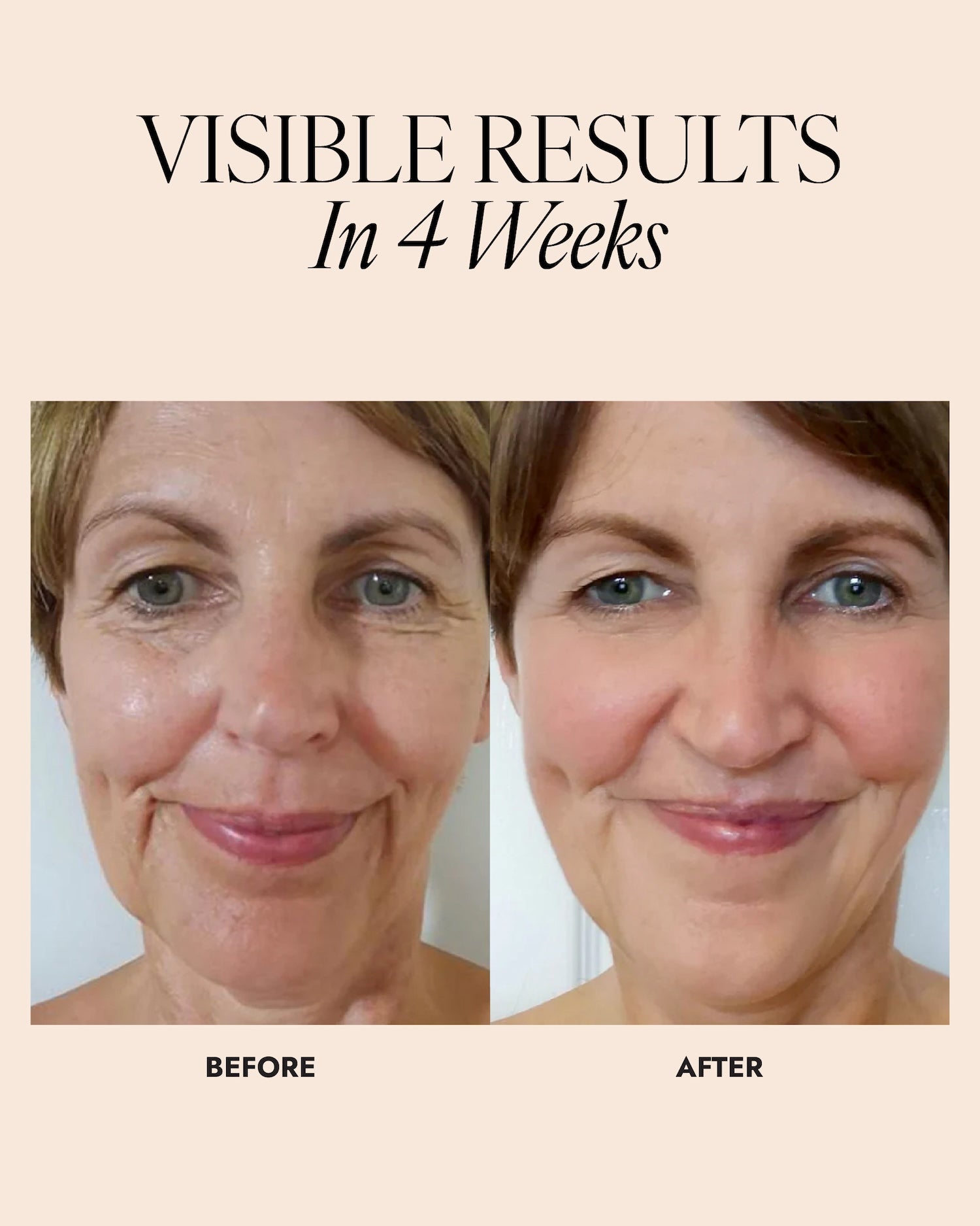 Before and after image of woman showing a reduction in lines and wrinkles in 4 weeks.
