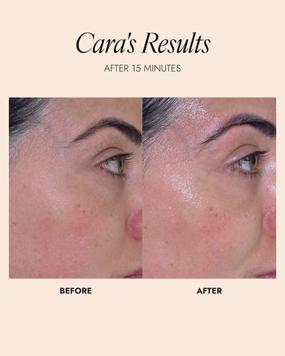 Before and after comparison of a person's face with text indicating glowing skin results after 15 minutes.