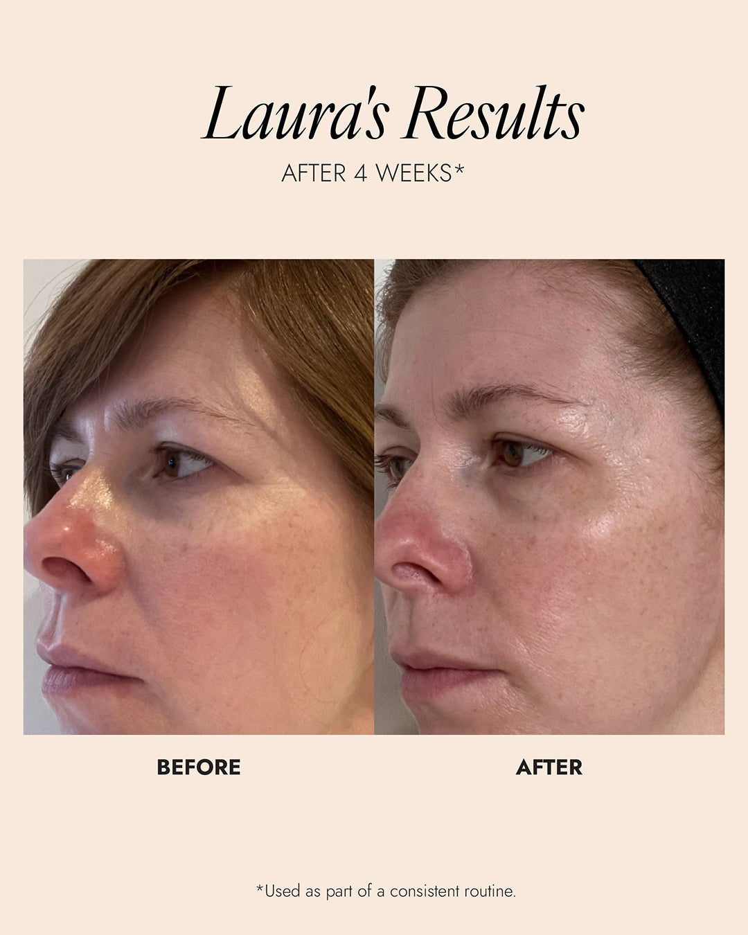 Overnight Retinol Powerbalm 50ml