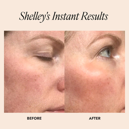 Before and after results of womans skin showing an improvement in skin luminosity. Text reads "Shelley's instant results"
