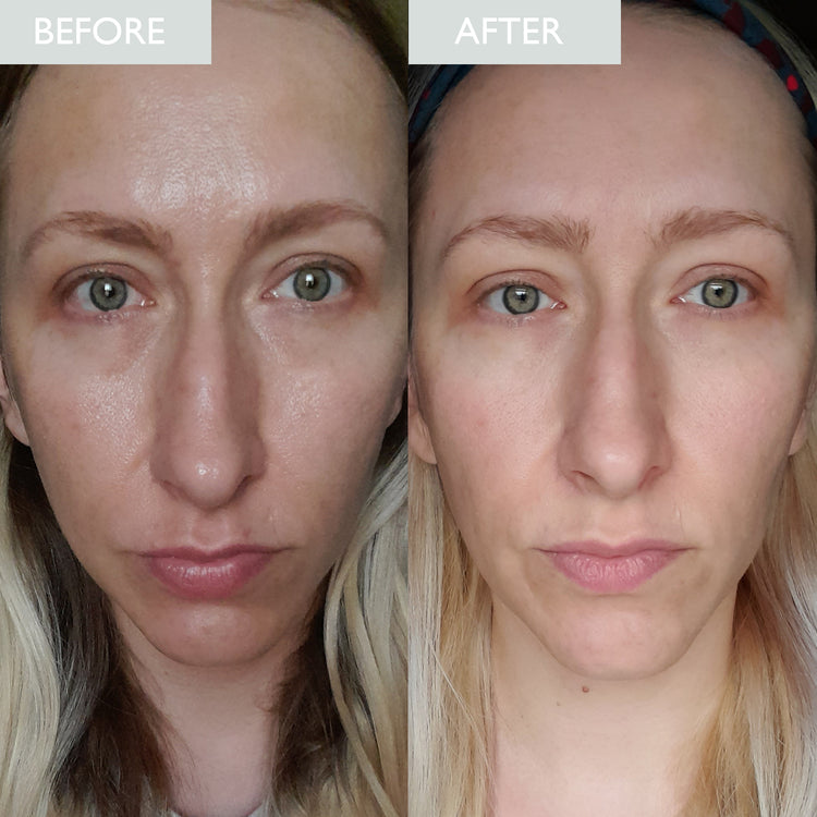 Zinc PCA Skin Care - Zinc PCA Benefits for Skin – SKINICIAN