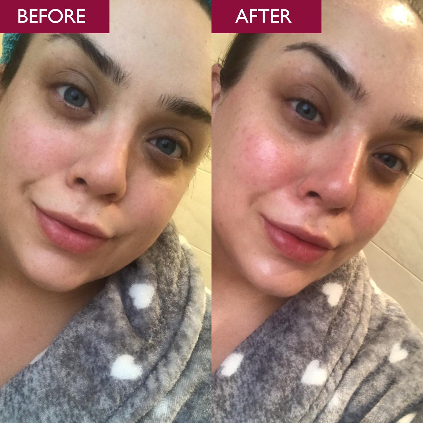 Before and after image of a lady showing brighter, less dull skin after using pro-radiance enzymatic cleanser