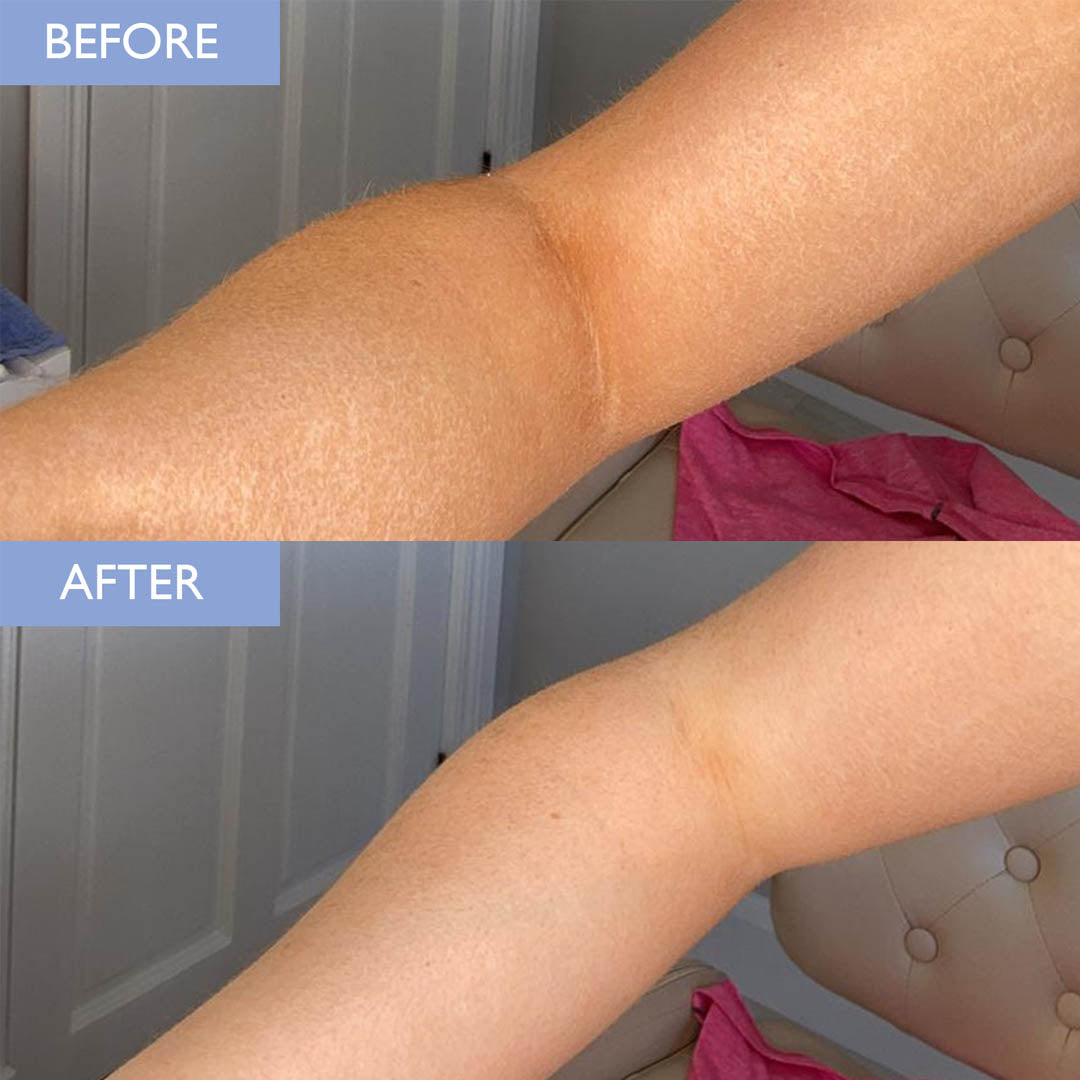 Before and after image of an arm with patchy self tan before, and a clear smooth looking arm after.
