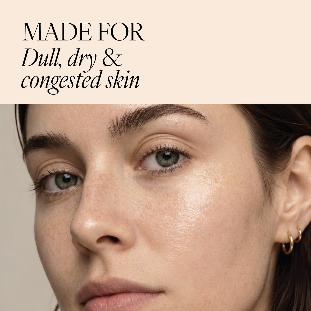Image of woman with text "Made for dull, dry and congested skin"