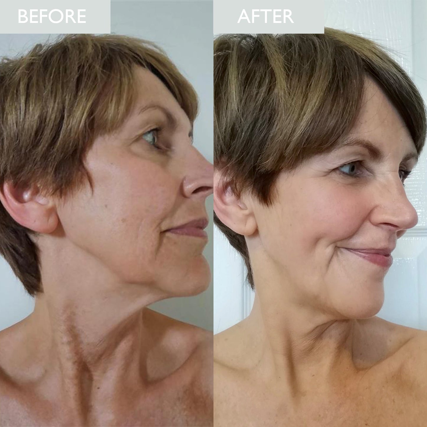 Before and after showing skin improvements in ageing and texture after using the anti-aging skincare kit.