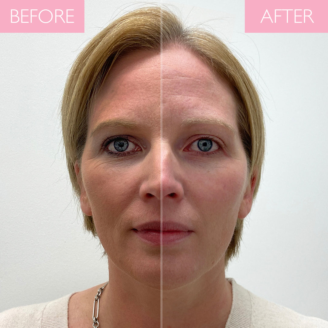 Before and after image using revitalising cleanser for make-up removal.