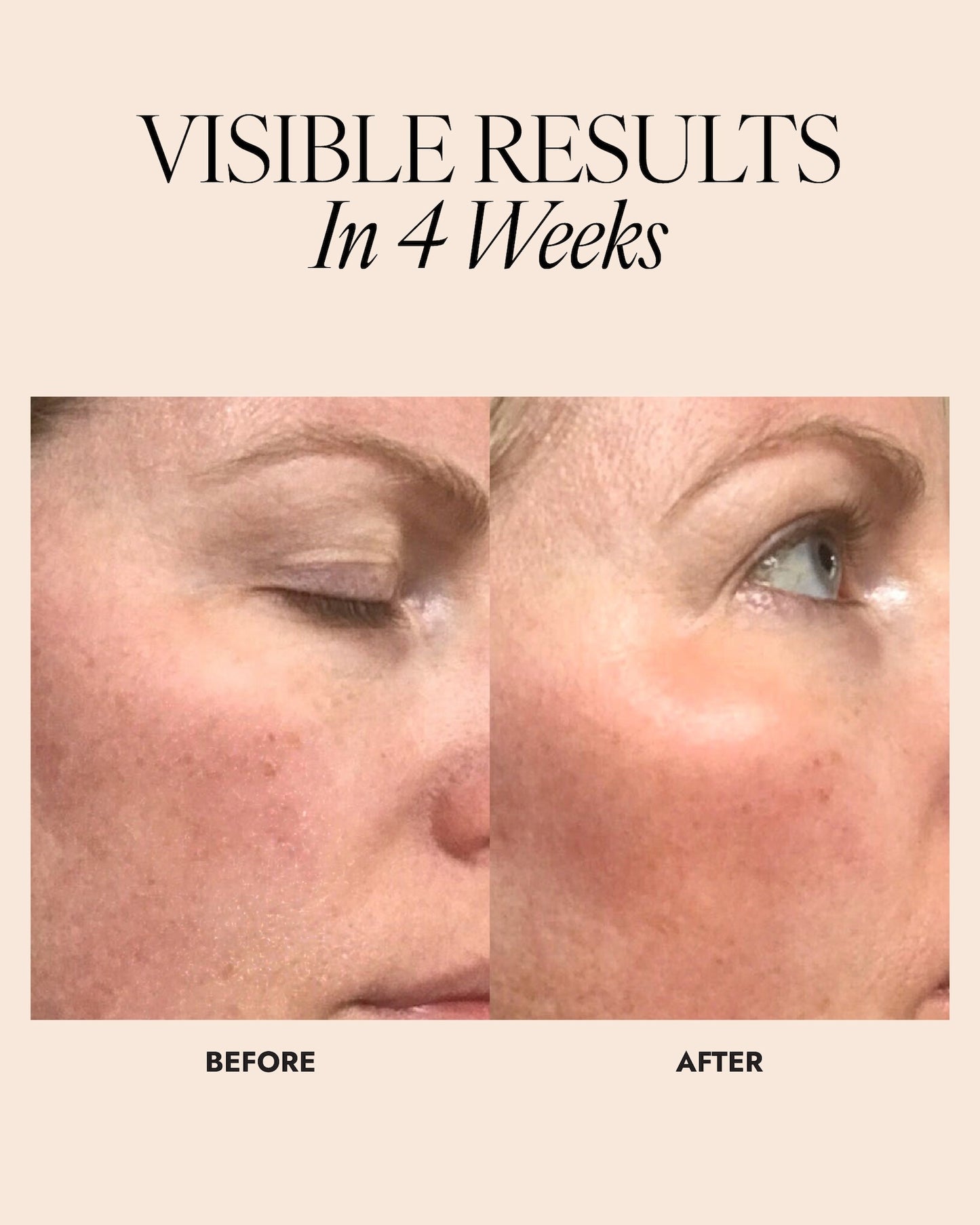 Before and after image of woman showing brighter and more luminous skin after 4 weeks.