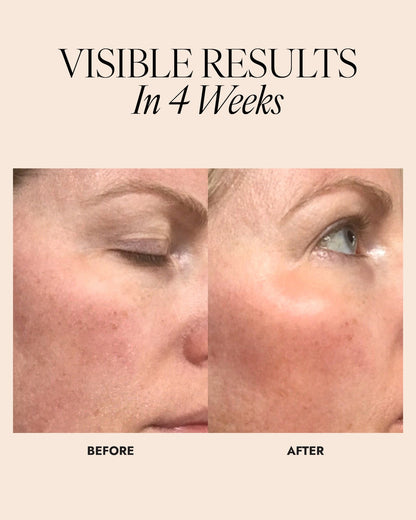 Before and after image of woman showing brighter and more luminous skin after 4 weeks.