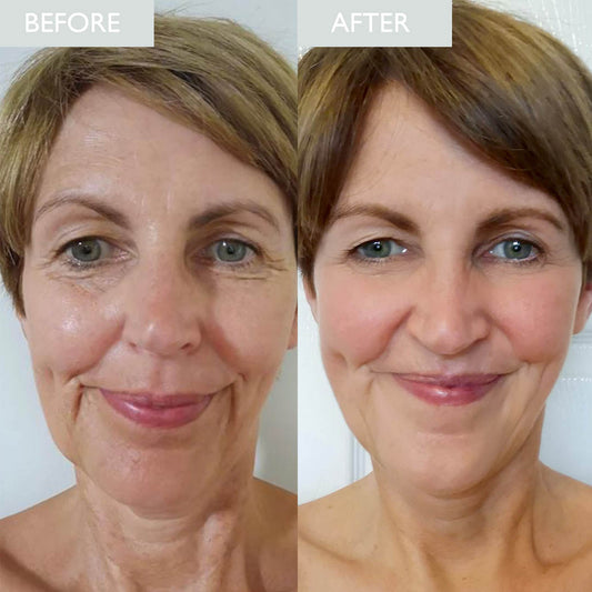 A before and after picture of a lady having used the items in the Retinol set